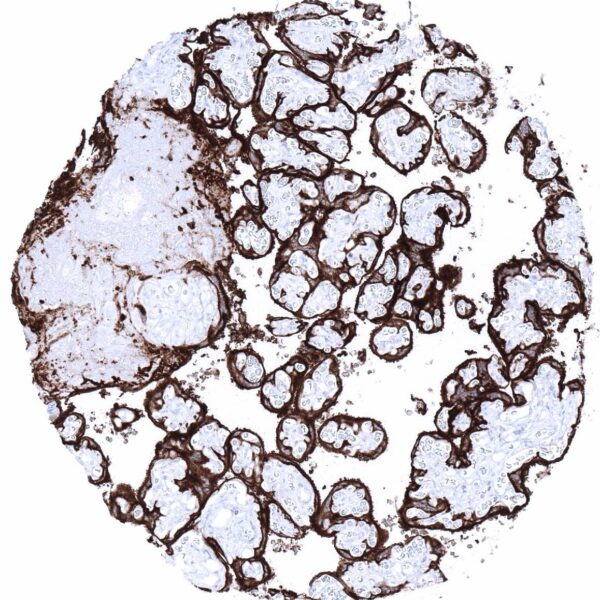 PLAP antibody clone MSVA-350R validated for immunohistochemistry from MS Validated Antibodies
