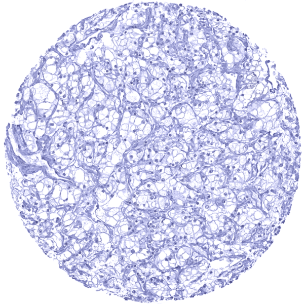 Cancer Tissue Gallery GP2 - MS Validated Antibodies