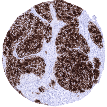 Cancer Tissue Gallery GP2 - MS Validated Antibodies