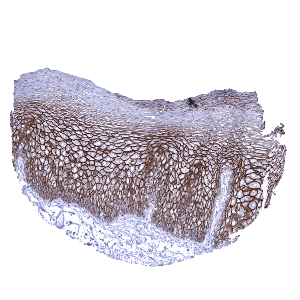 Desmoglein 3 (MSVA543M) MS Validated Antibodies