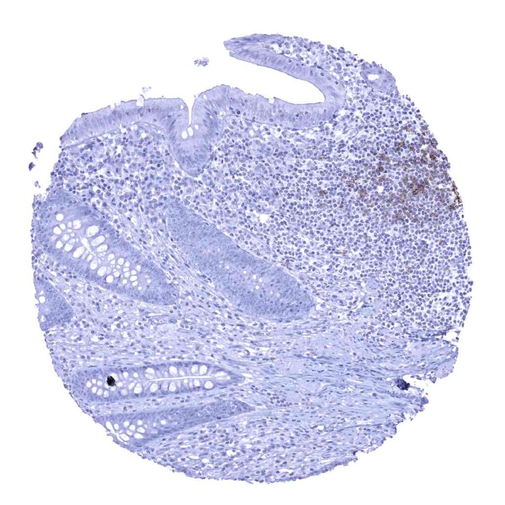 Cd23 Positive CD23 (MSVA-023M) - MS Validated Antibodies