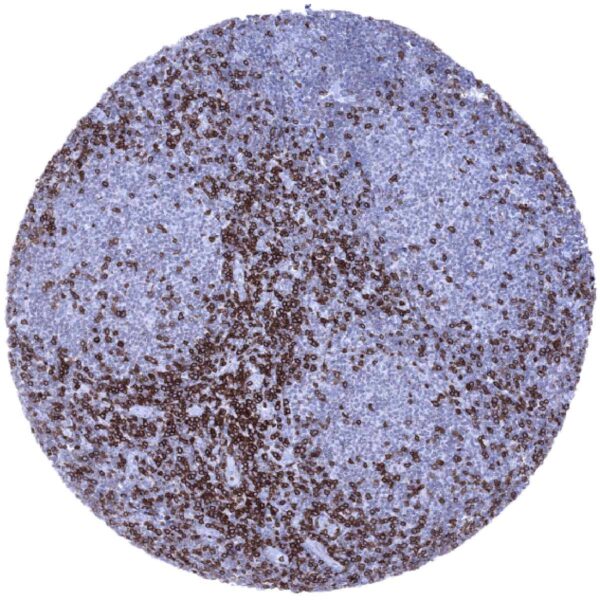 Cancer Tissue Gallery CD3 - MS Validated Antibodies