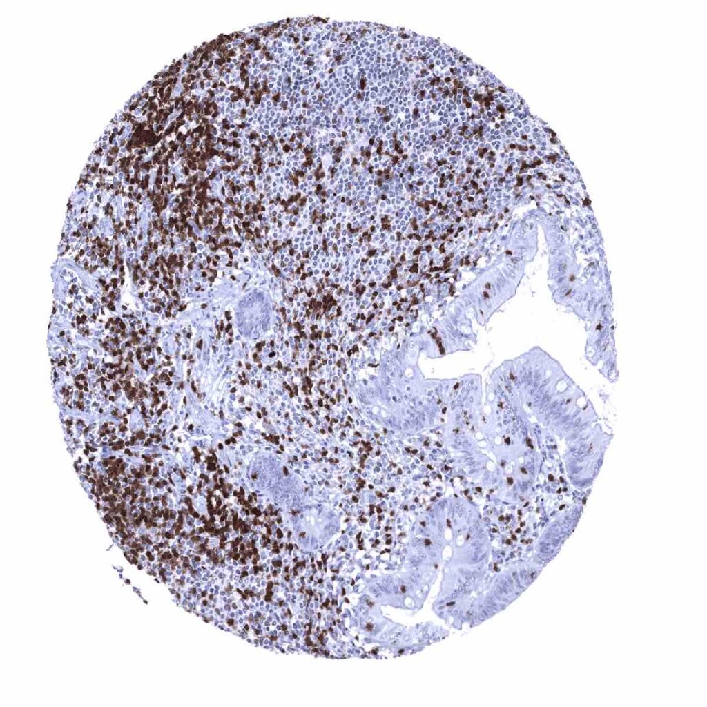 Zap Appendix ZAP-70 (MSVA-870R) - MS Validated Antibodies