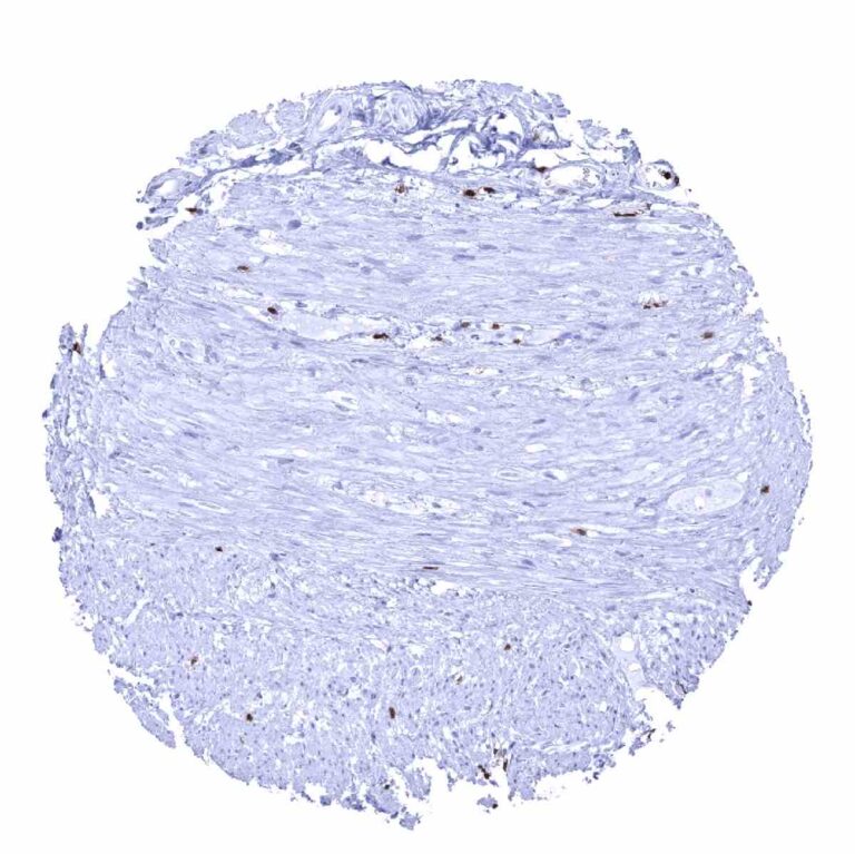 Zap Appendix Normal Tissue Gallery ZAP-70 - MS Validated Antibodies