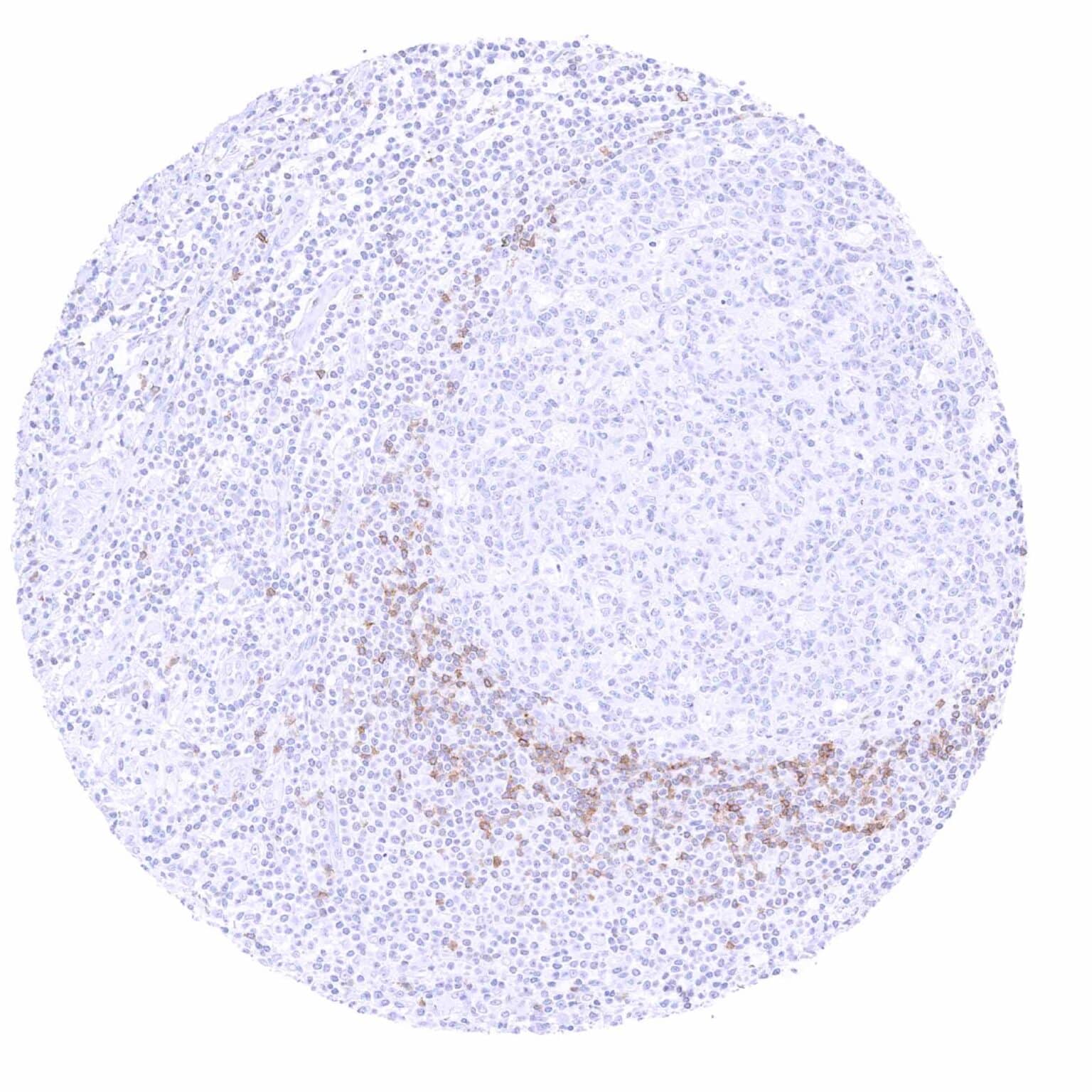 Normal Tissue Gallery IgD - MS Validated Antibodies