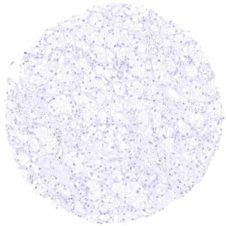Igd Rscm Cancer Tissue Gallery IgD - MS Validated Antibodies