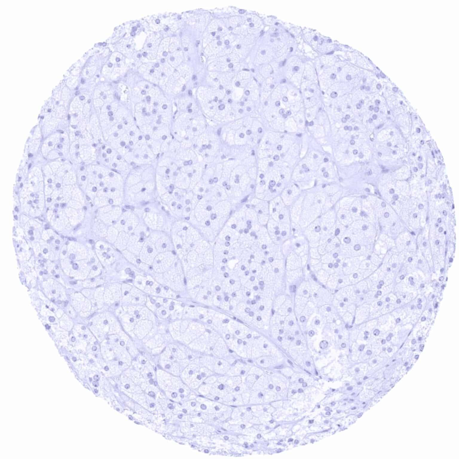 Cancer Tissue Gallery TRPS1 - MS Validated Antibodies