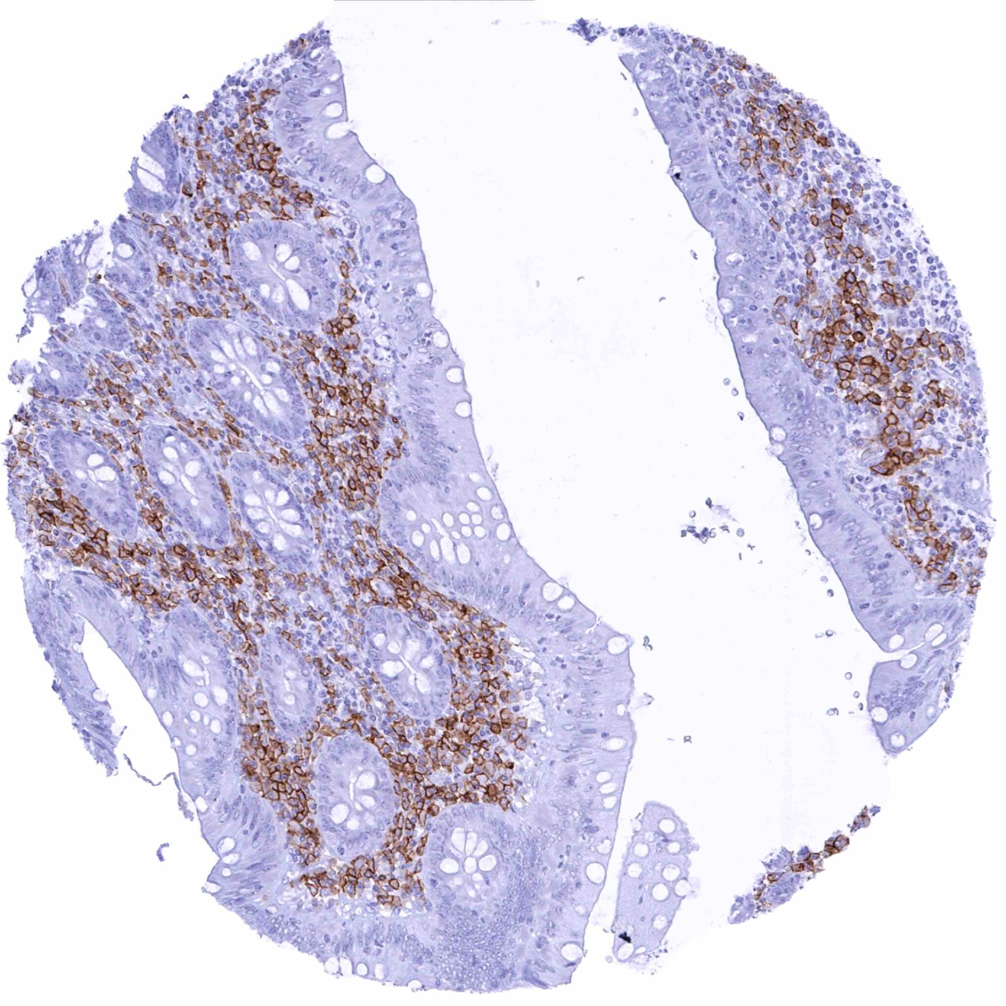 Normal Tissue Gallery CD38 - MS Validated Antibodies