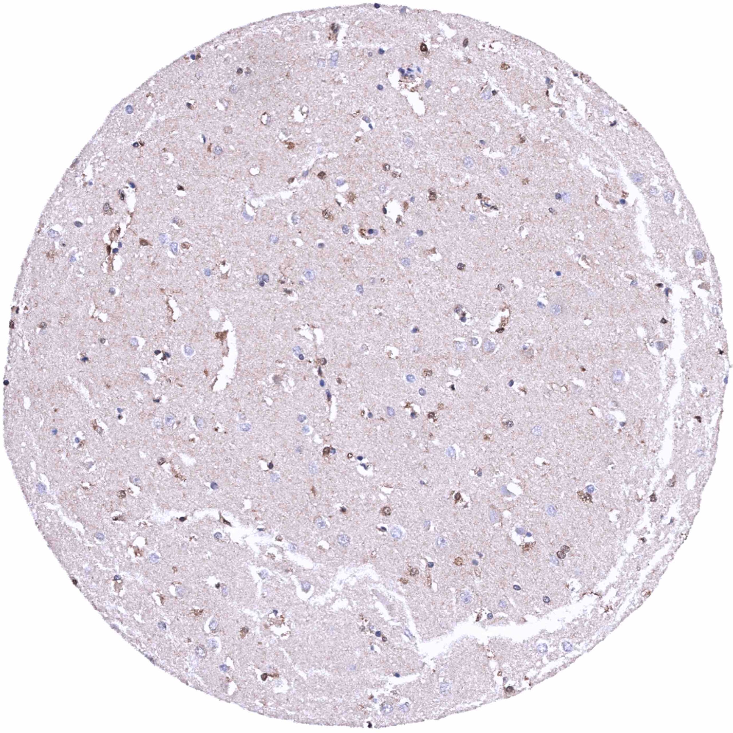 Normal Tissue Gallery MTAP - MS Validated Antibodies