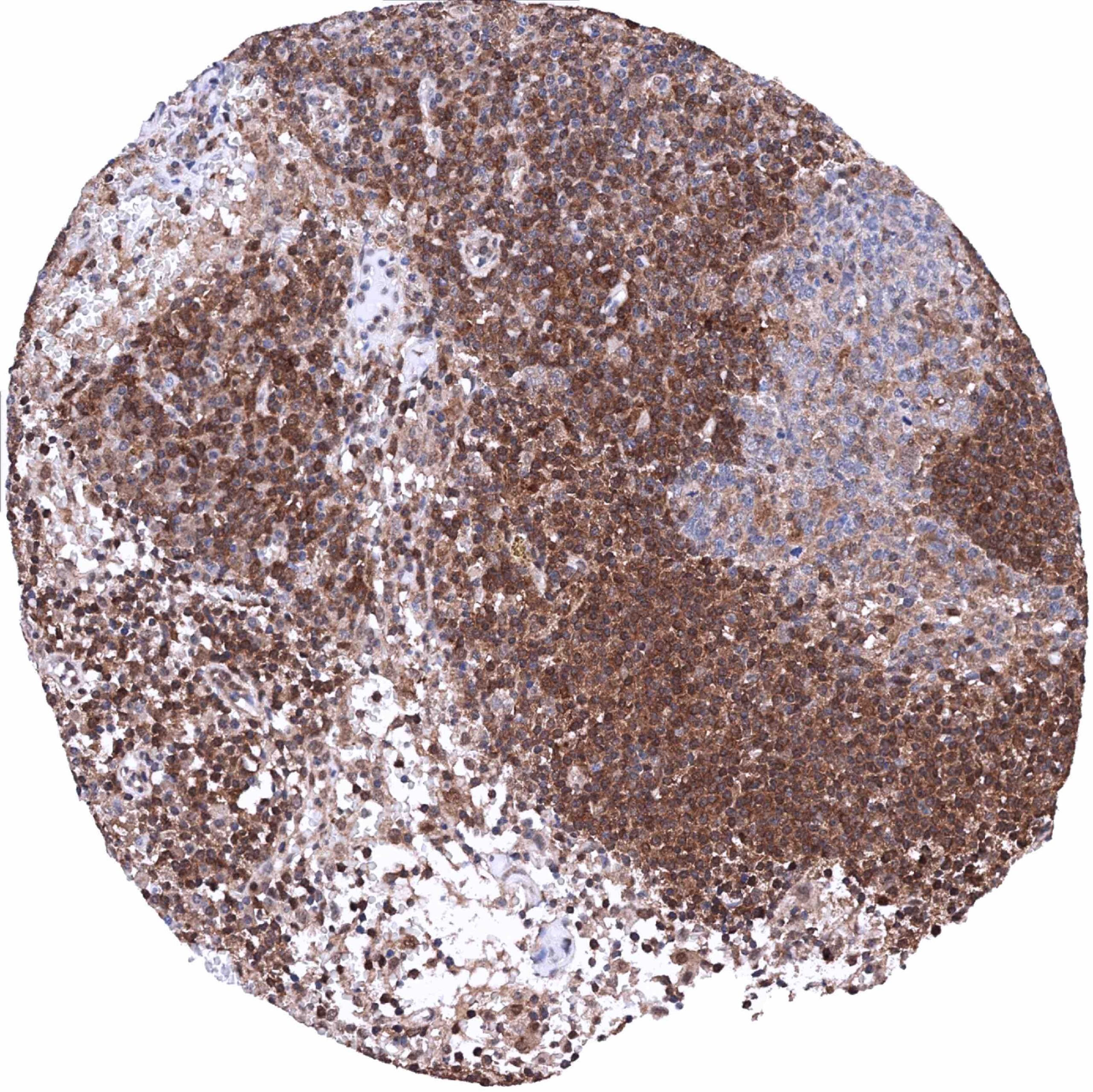 Normal Tissue Gallery MTAP - MS Validated Antibodies