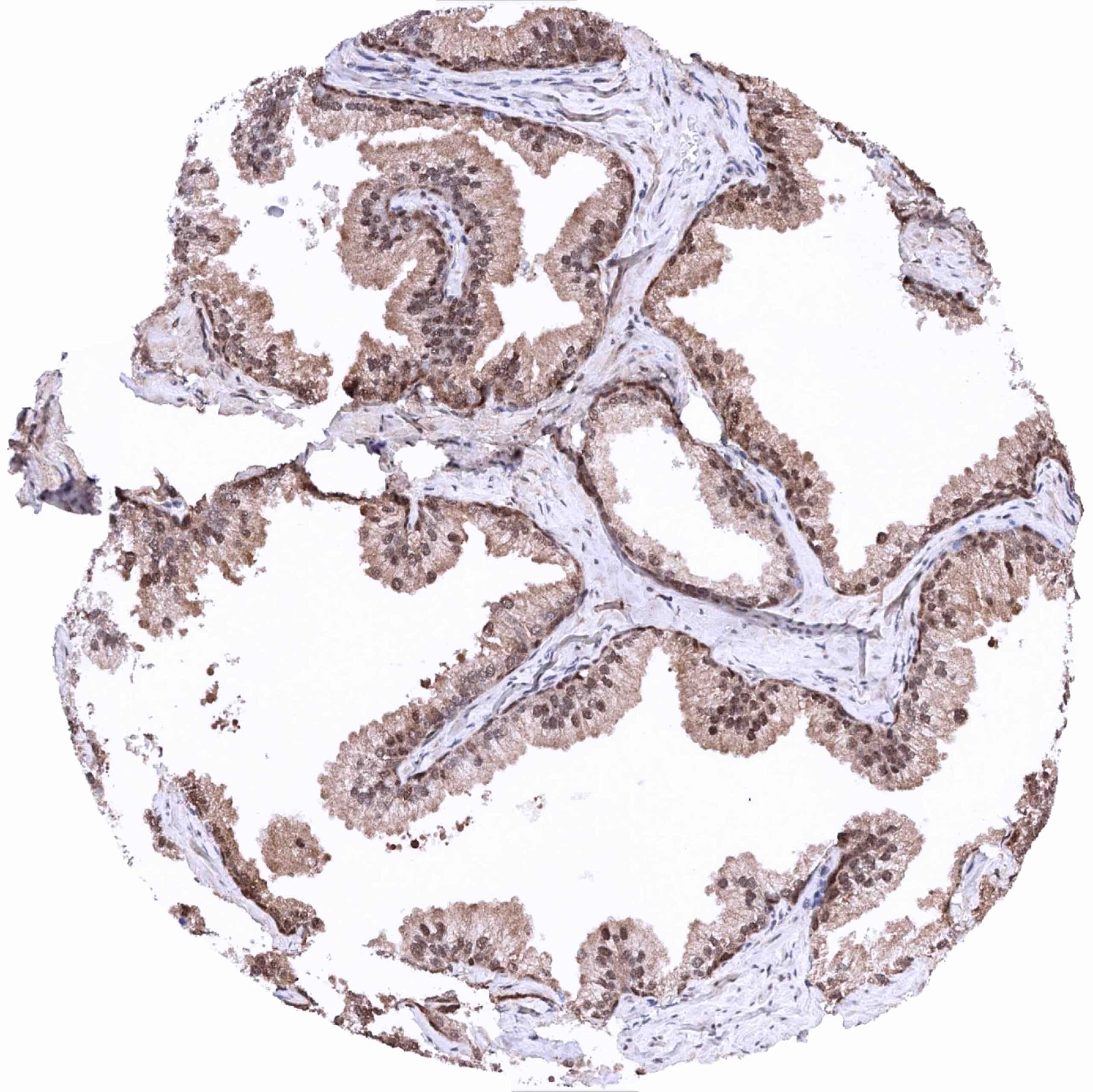 Normal Tissue Gallery MTAP - MS Validated Antibodies