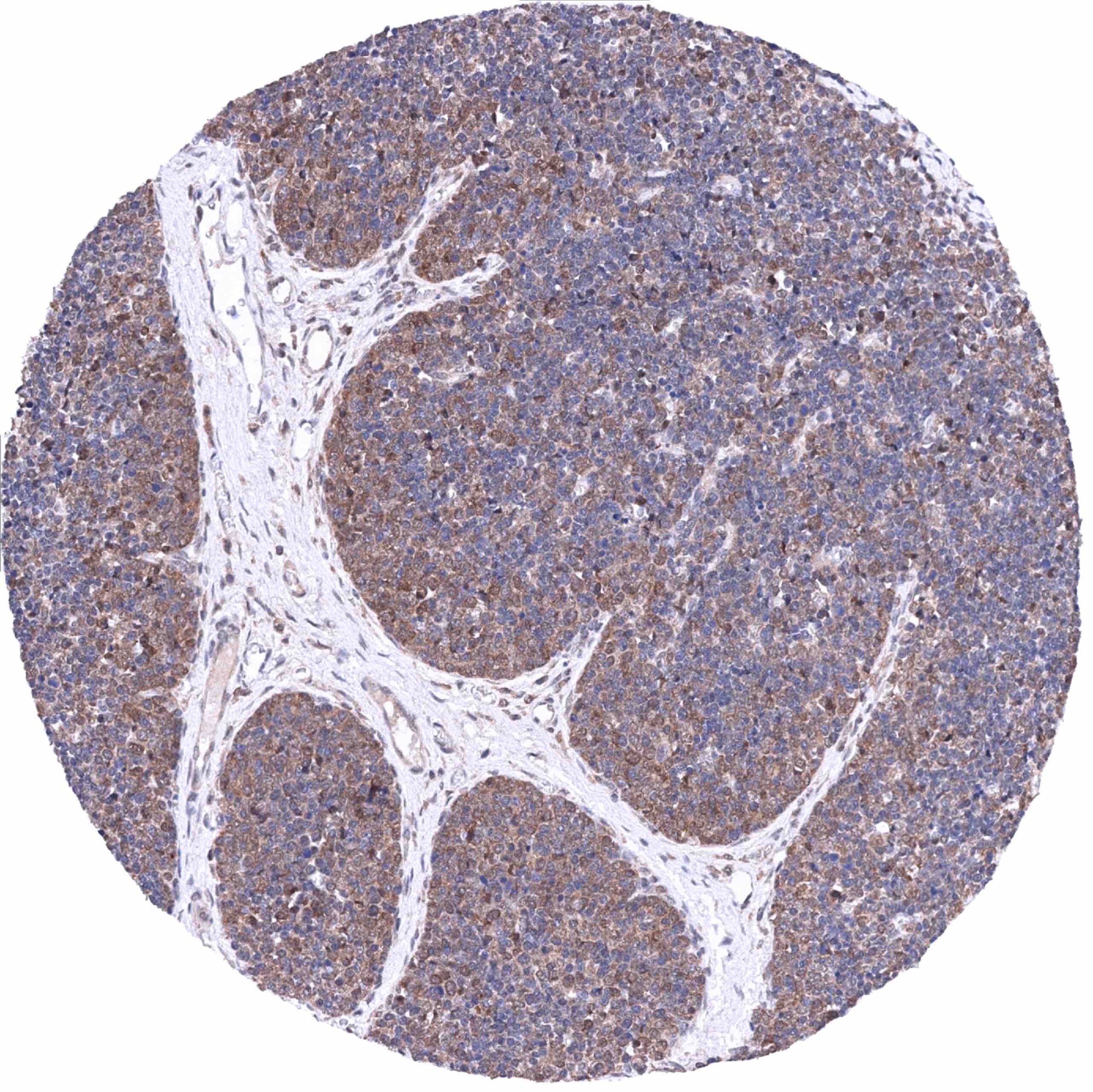 Normal Tissue Gallery MTAP - MS Validated Antibodies