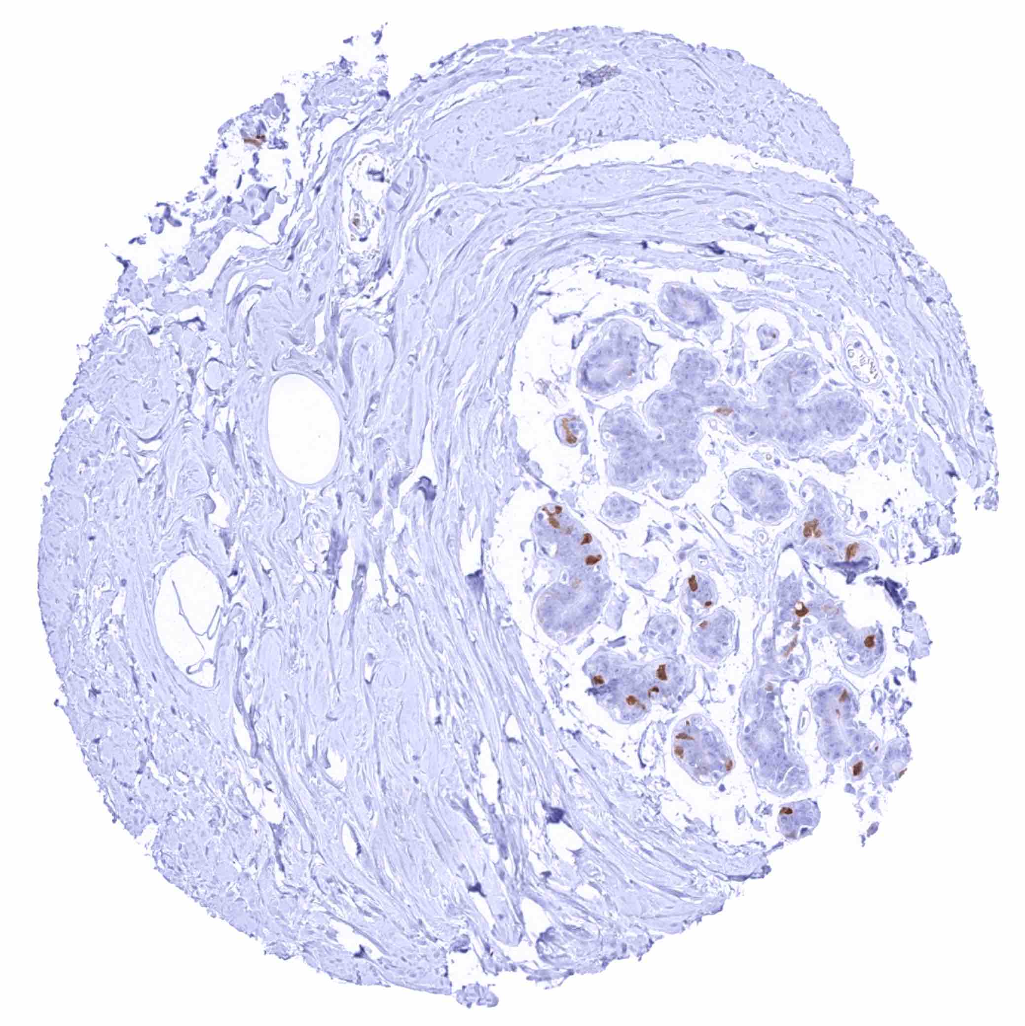 Normal Tissue Gallery TYMS - MS Validated Antibodies