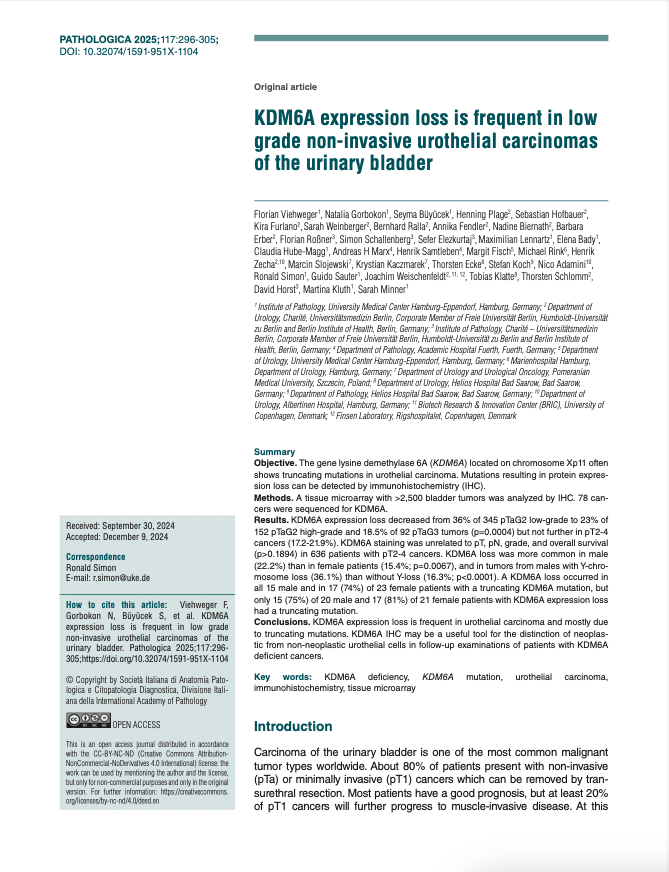Viehweger et al. “KDM6A expression loss is frequent in low grade non-invasive urothelial carcinomas of the urinary bladder” Published in Pathologica 2025; 117-296-305 DOI: 10.32074/1591-951X-1104