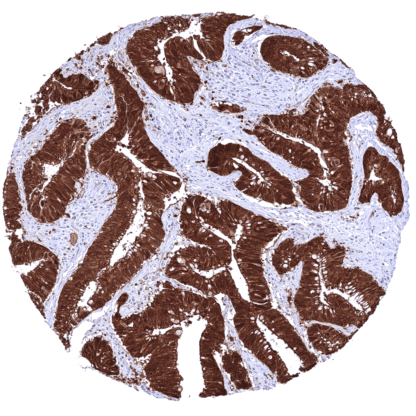 Beta-Catenin (MSVA-578R) - Image 3