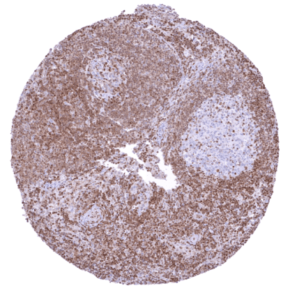 p27 / Kip1 (HMV3970) - Image 2