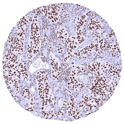 BRD4 (HMV4275) - Image 3