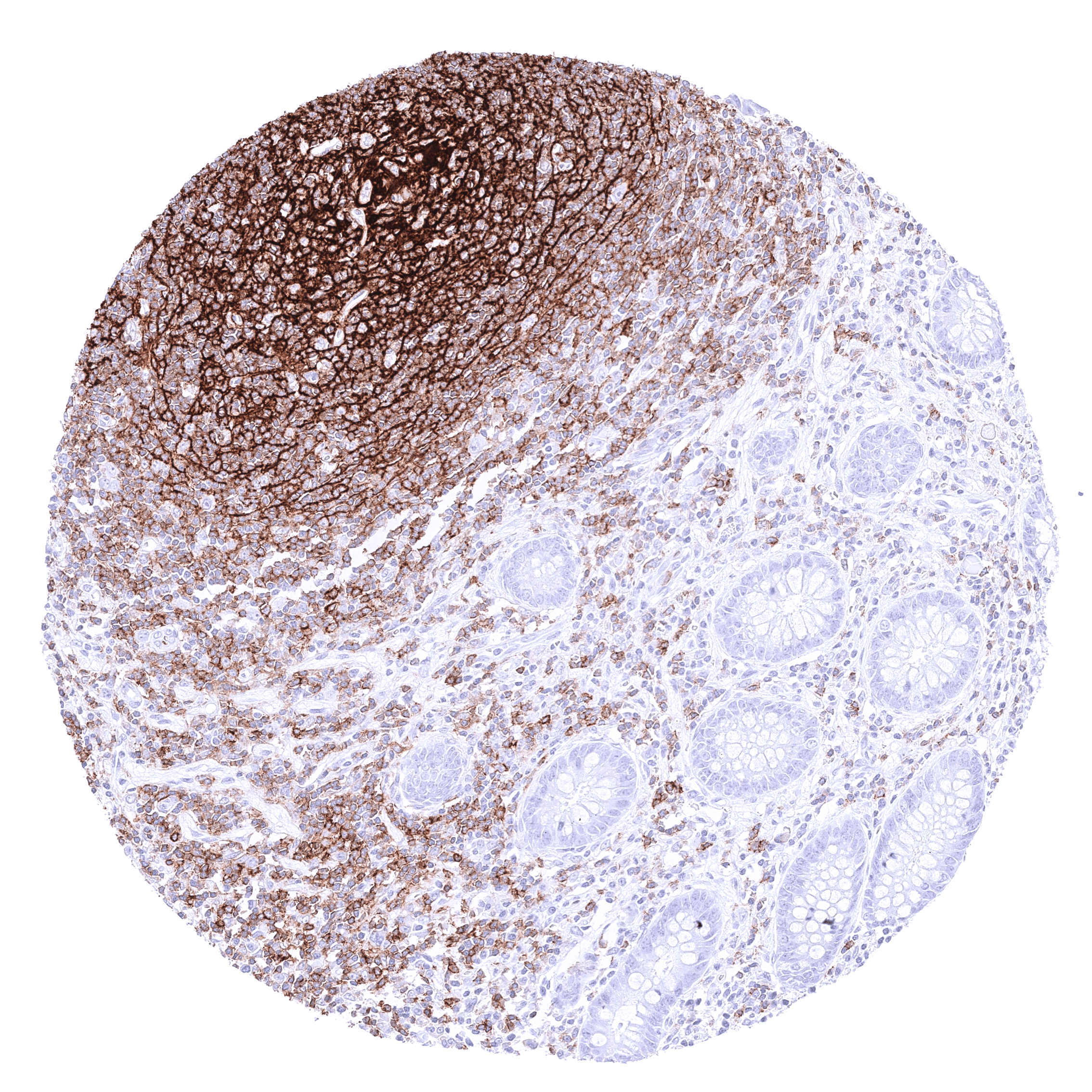 CD35 (MSVA-035M) - Image 2