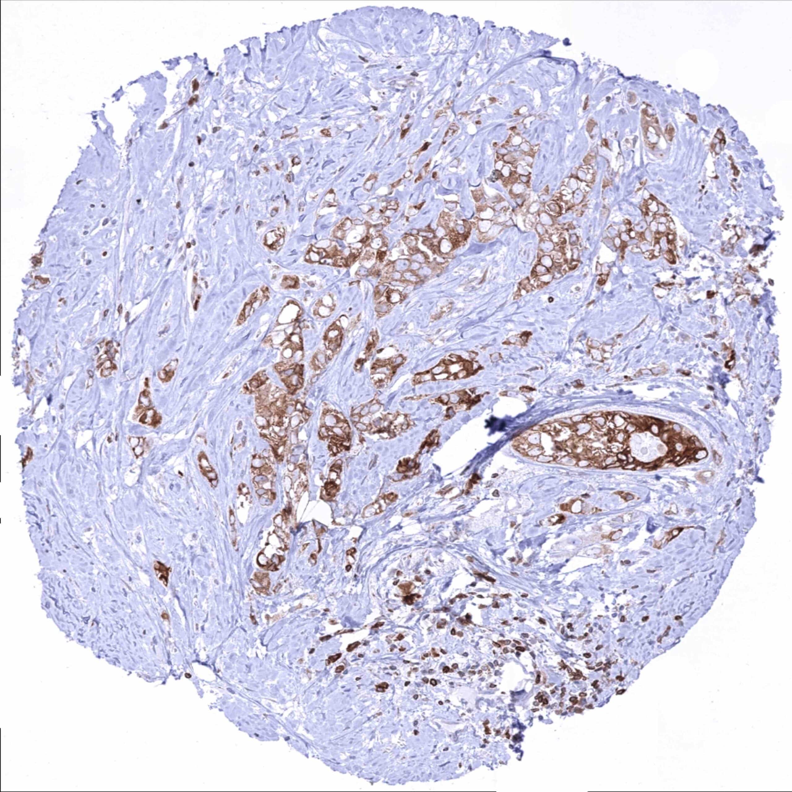 Cancer Tissue Gallery Bcl-2 - MS Validated Antibodies
