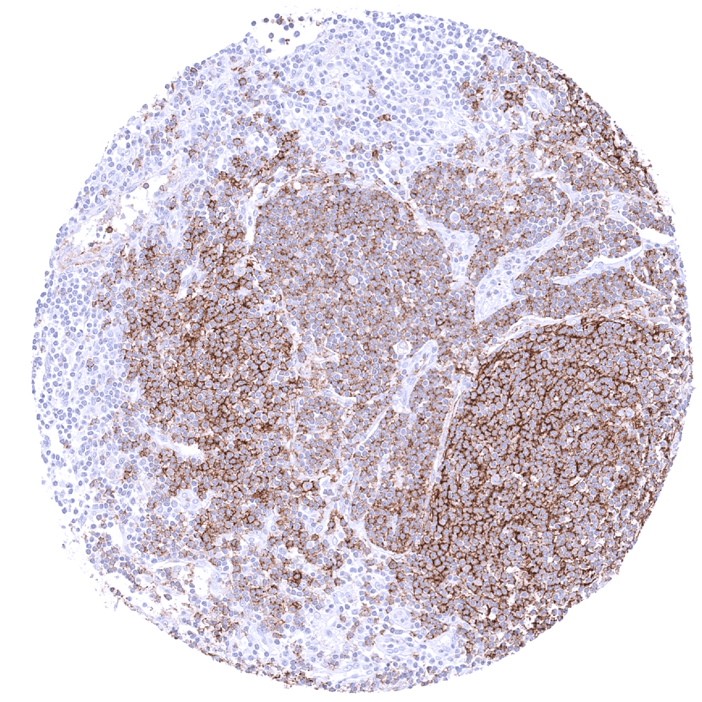 CD35 (MSVA-035M) - Image 4