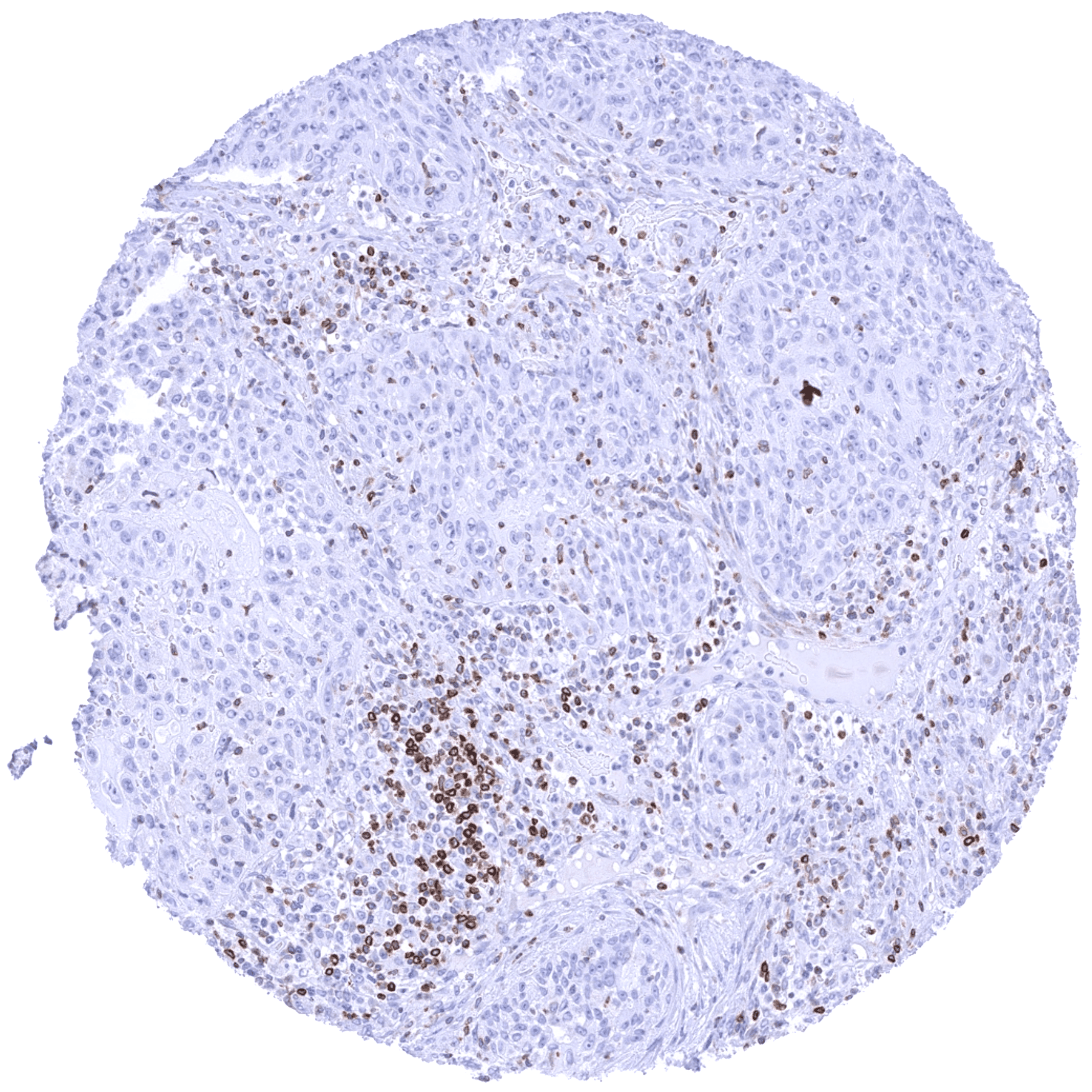 Bcl-2 (MSVA-402M) - Image 4