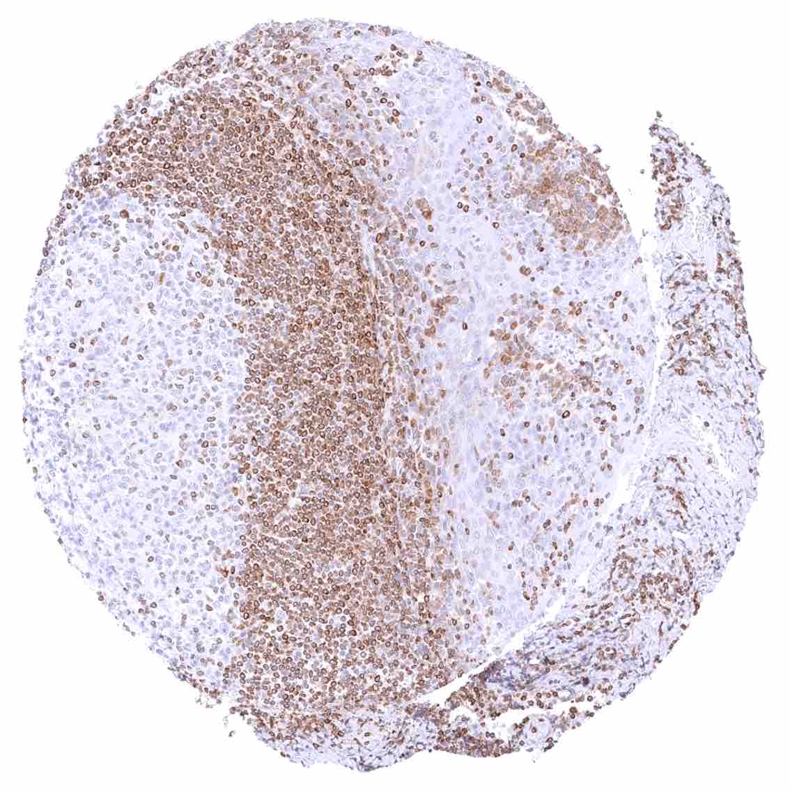 Bcl-2 (MSVA-402M) - Image 2