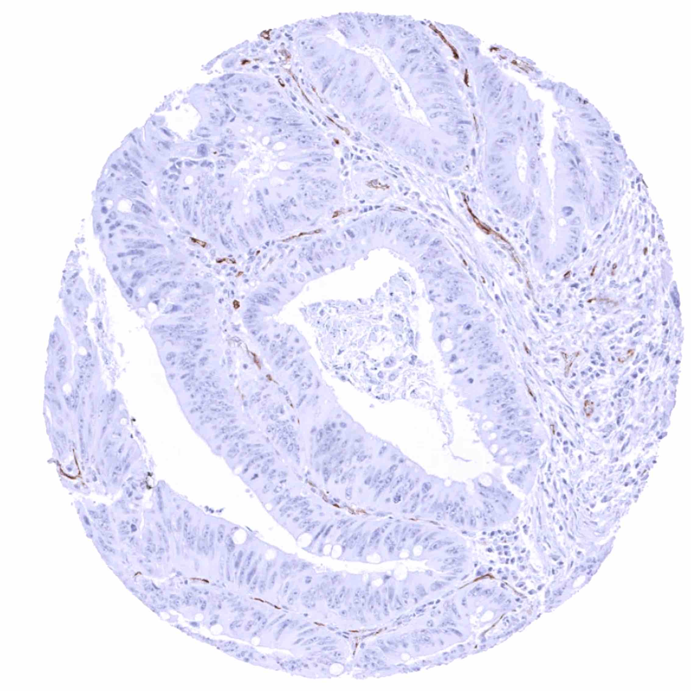 Cancer Tissue Gallery PSMA - MS Validated Antibodies