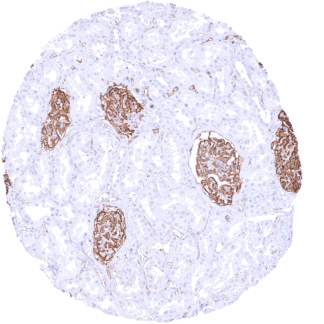 Podocalyxin / PODXL (MSVA-645M)