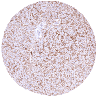 SLC6A1 / GAT1 (HMV4721)