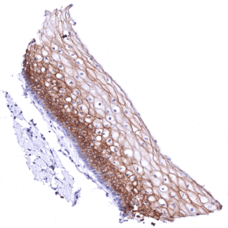 Nectin-4 (MSVA-304M)