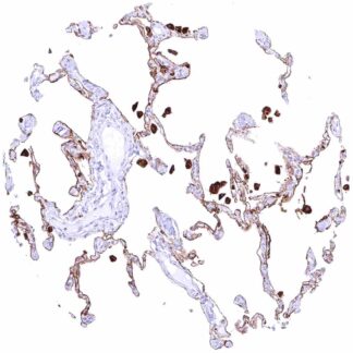 CEACAM6 (MSVA-066R)