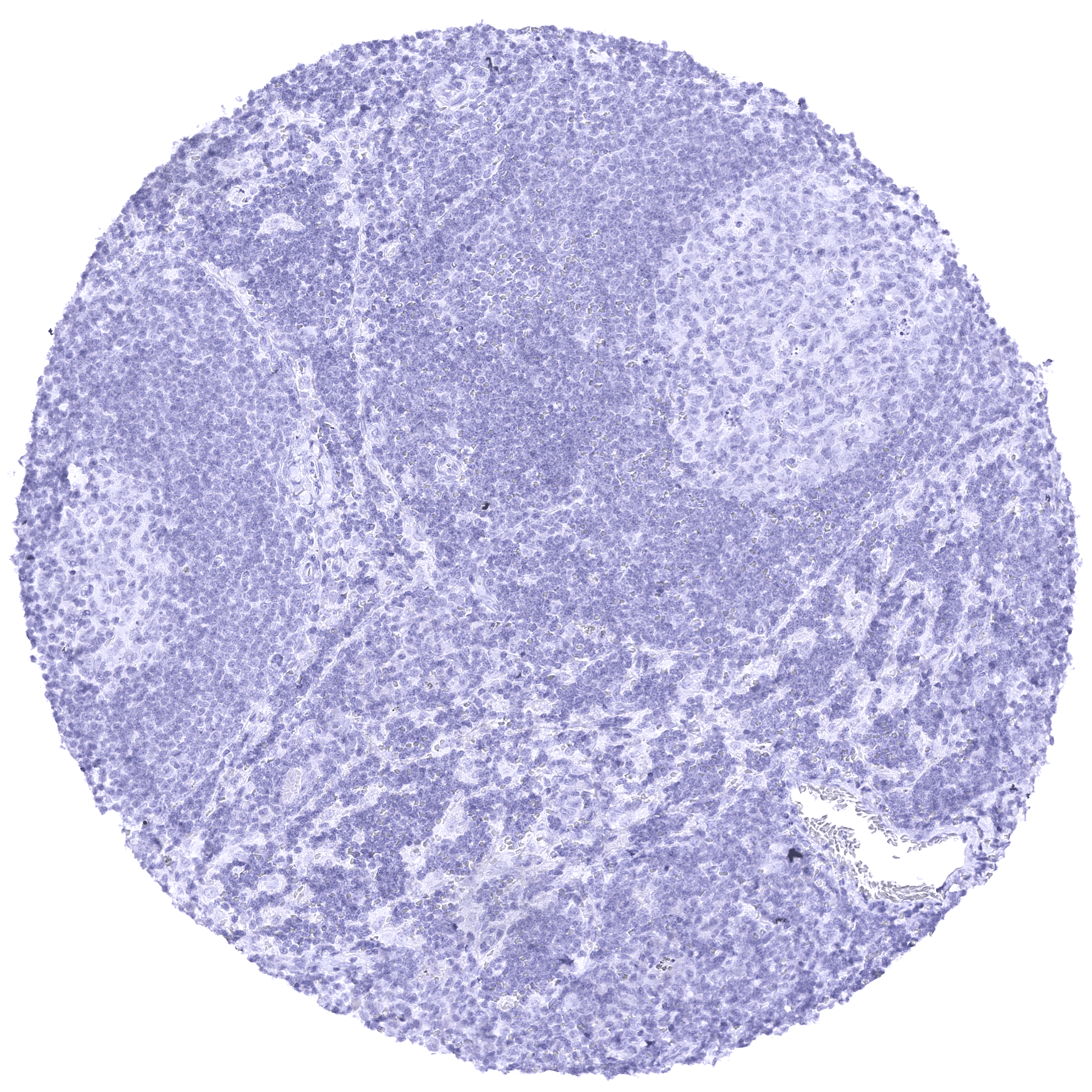 Nectin-4 (MSVA-304M) - Image 3