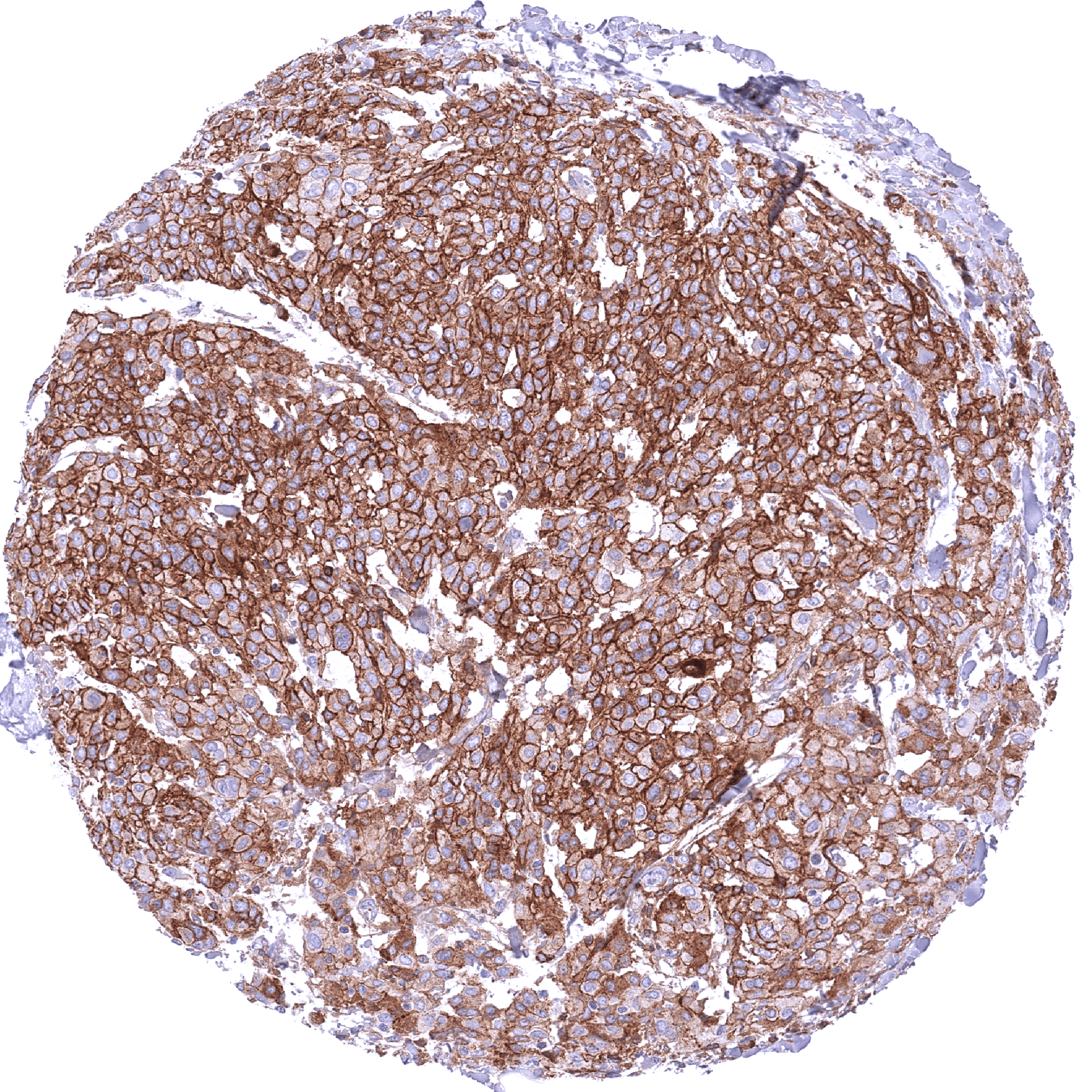 Nectin-4 (MSVA-304M) - Image 4