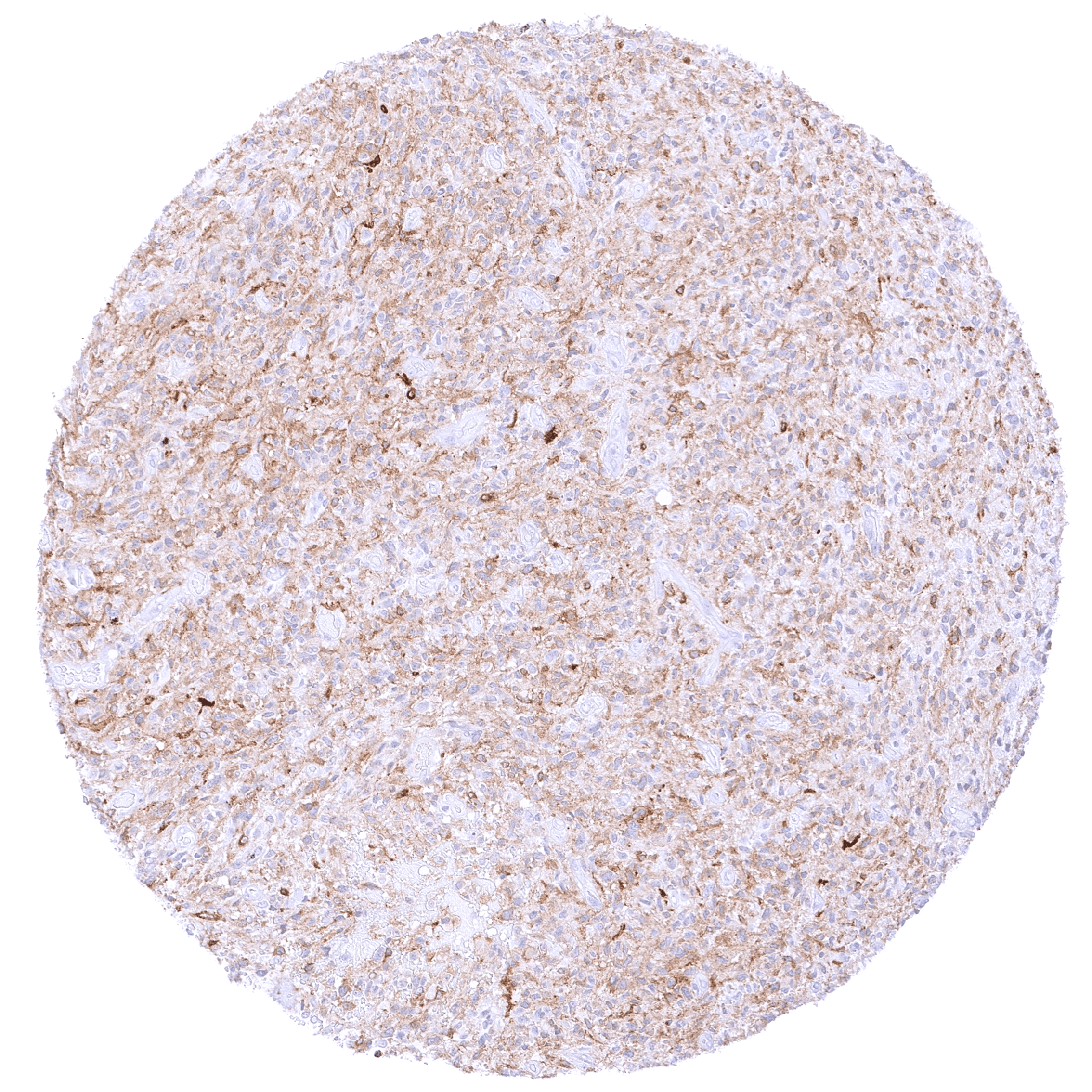 EGFRvIII (HMV3805) - Image 2