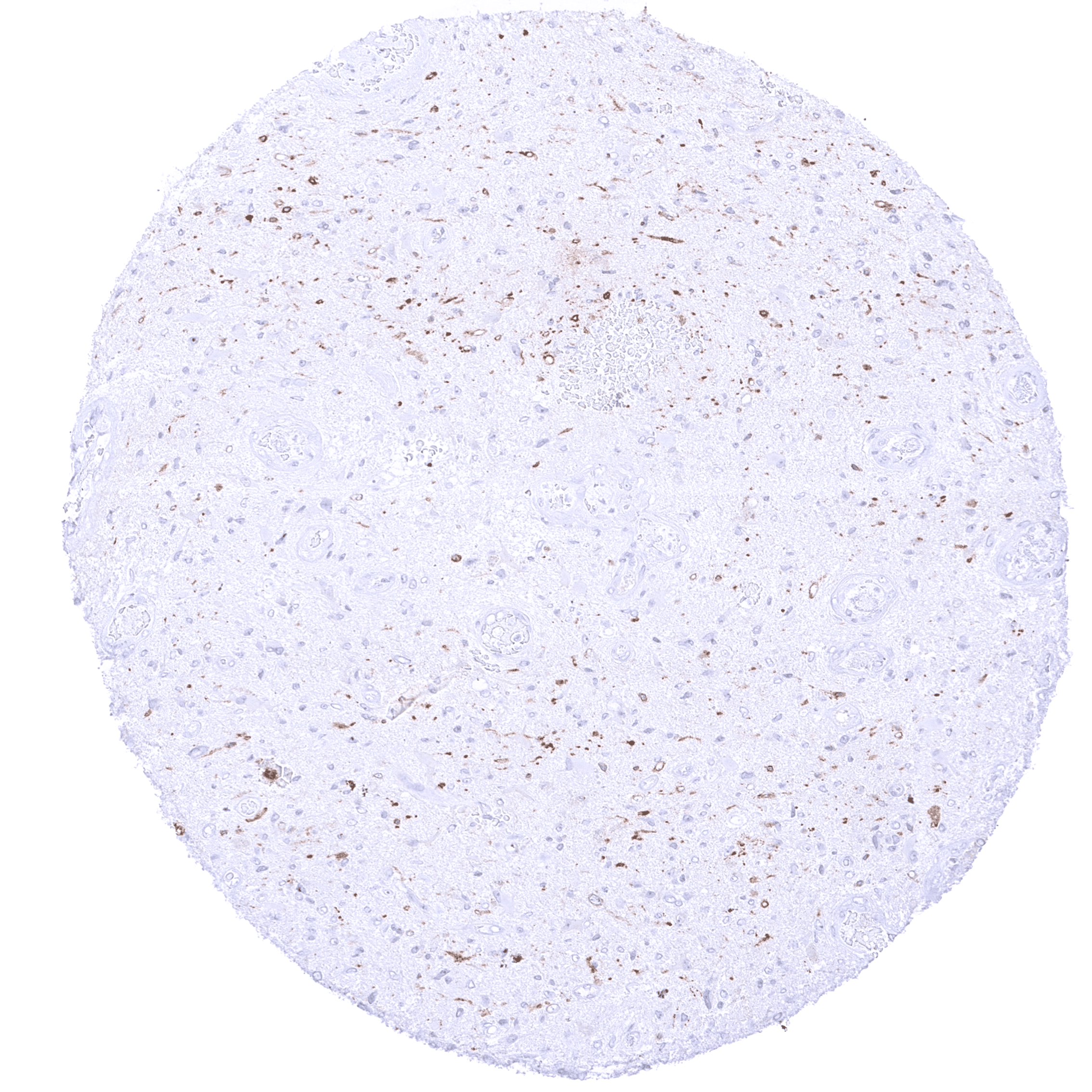 EGFRvIII (HMV3805) - Image 3