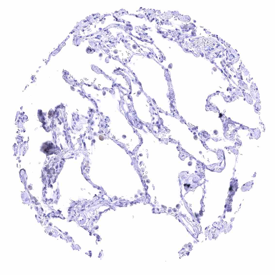 Claudin 18.2 (HMV4729) - Image 3
