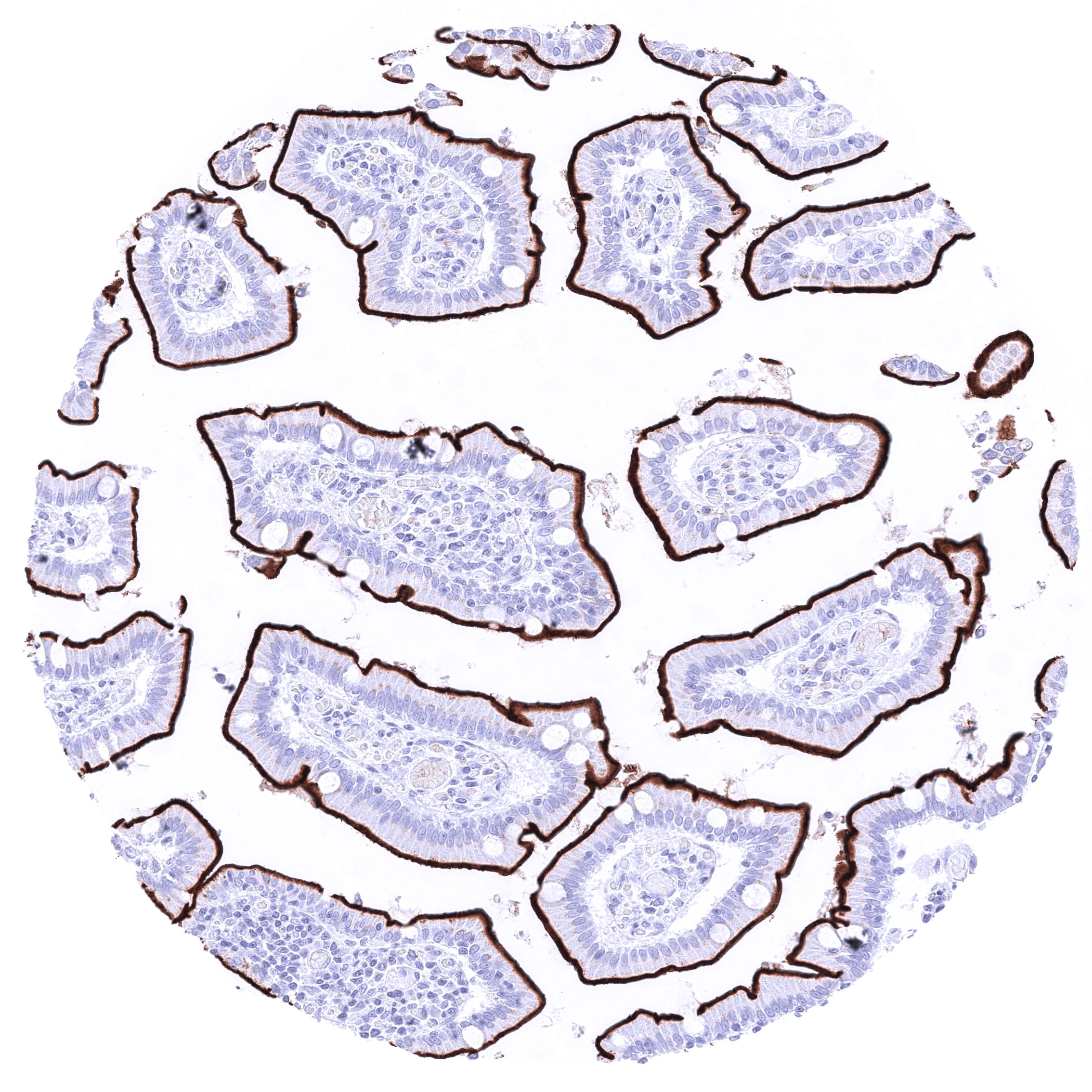 GPRC5A (HMV4717) - Image 3